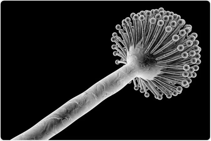 Aspergillosis